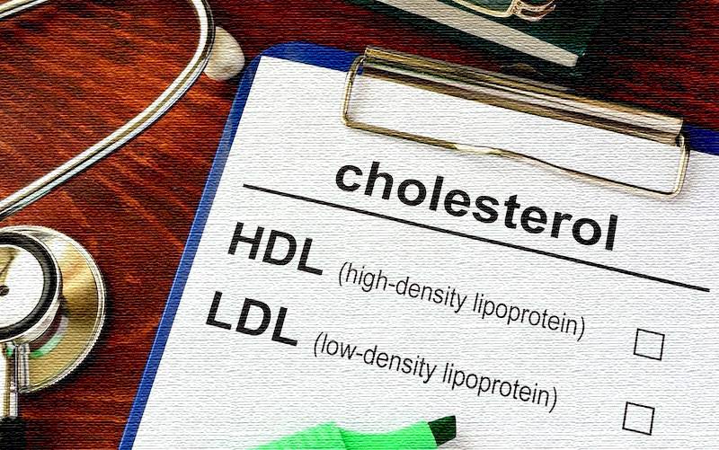 고밀도 콜레스테롤의 특성과 기능